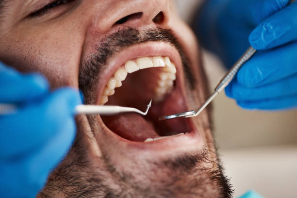 Best Emergency Broken Tooth Repair in Micco, FL